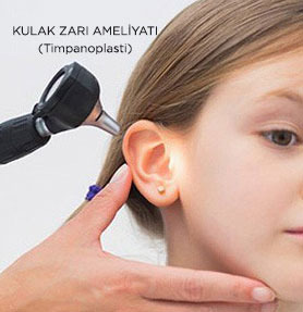 Timpanoplasti (Kulak Zarı Ameliyatı)