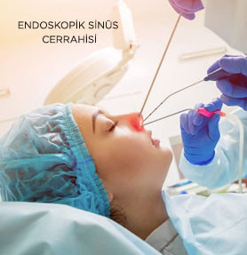 Endoskopik Sinüs Cerrahisi